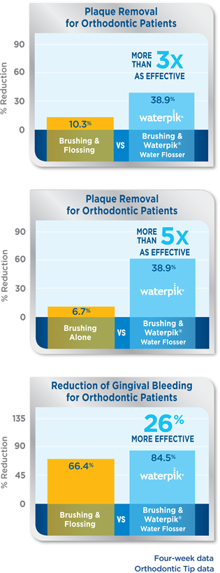 Ирригатор Waterpik с орто-насадкой в 3 раза эффективнее при ортодонтическом лечении